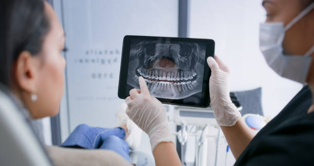 Licensed Tooth Extraction service in Maryville, MO - Smile Center Dentistry